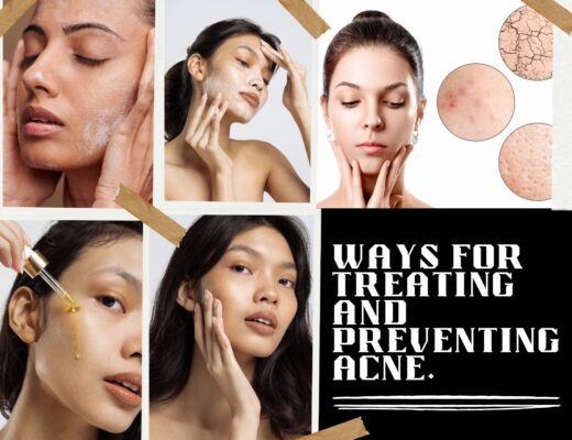 Ways For Treating And Preventing Acne