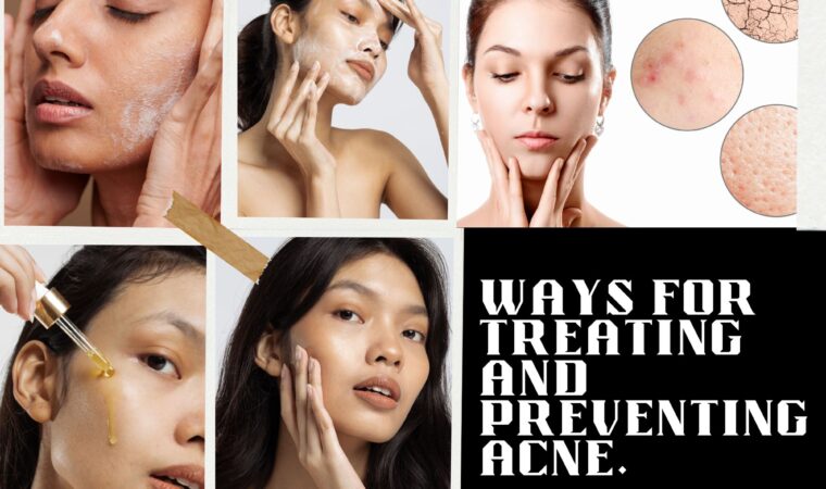 Ways For Treating And Preventing Acne