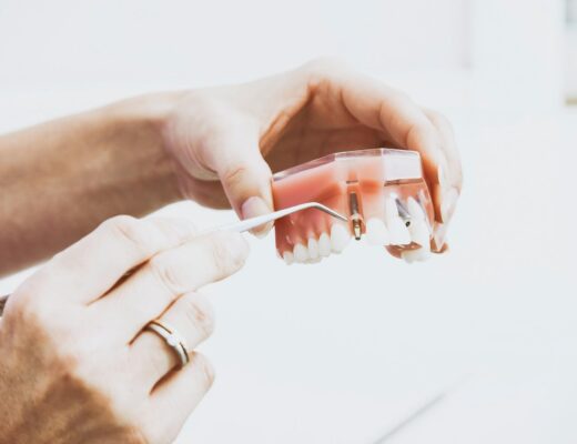 Dental Implants For Nervous Patients