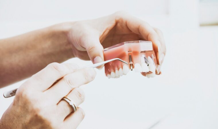 Dental Implants For Nervous Patients