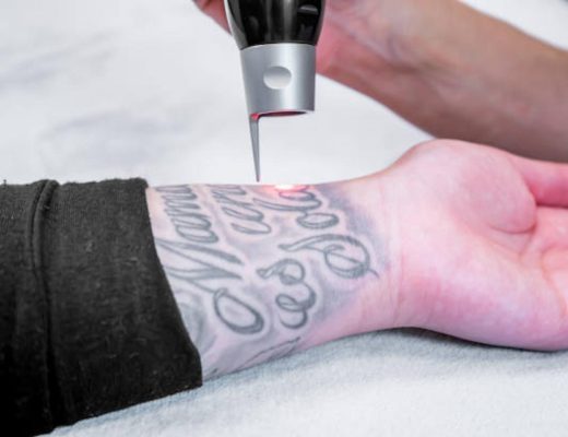 8 Tips To Speed Up Your Tattoo Removal Journey