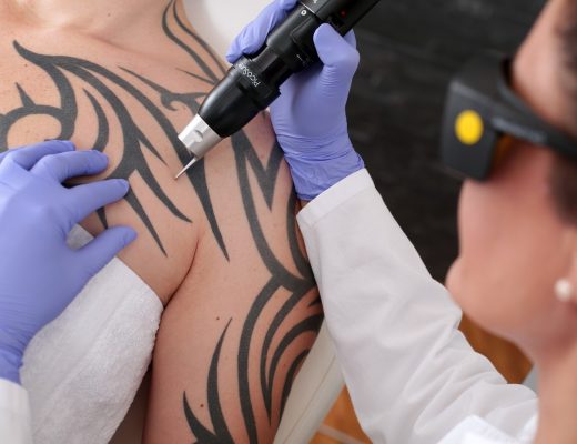 Five Tips For Choosing The Right Laser Tattoo Removal Service