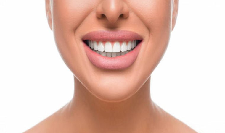 5 Reasons To Get Teeth Whitening